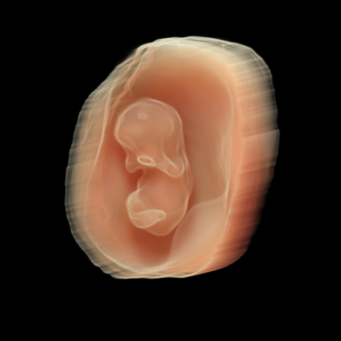 Fetus 10 weeks silhouette Fetus 10 weeks silhouette