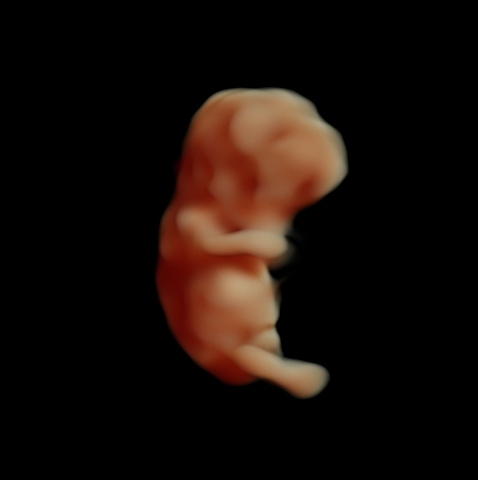 Fetus 10 weeks Fetus 10 weeks